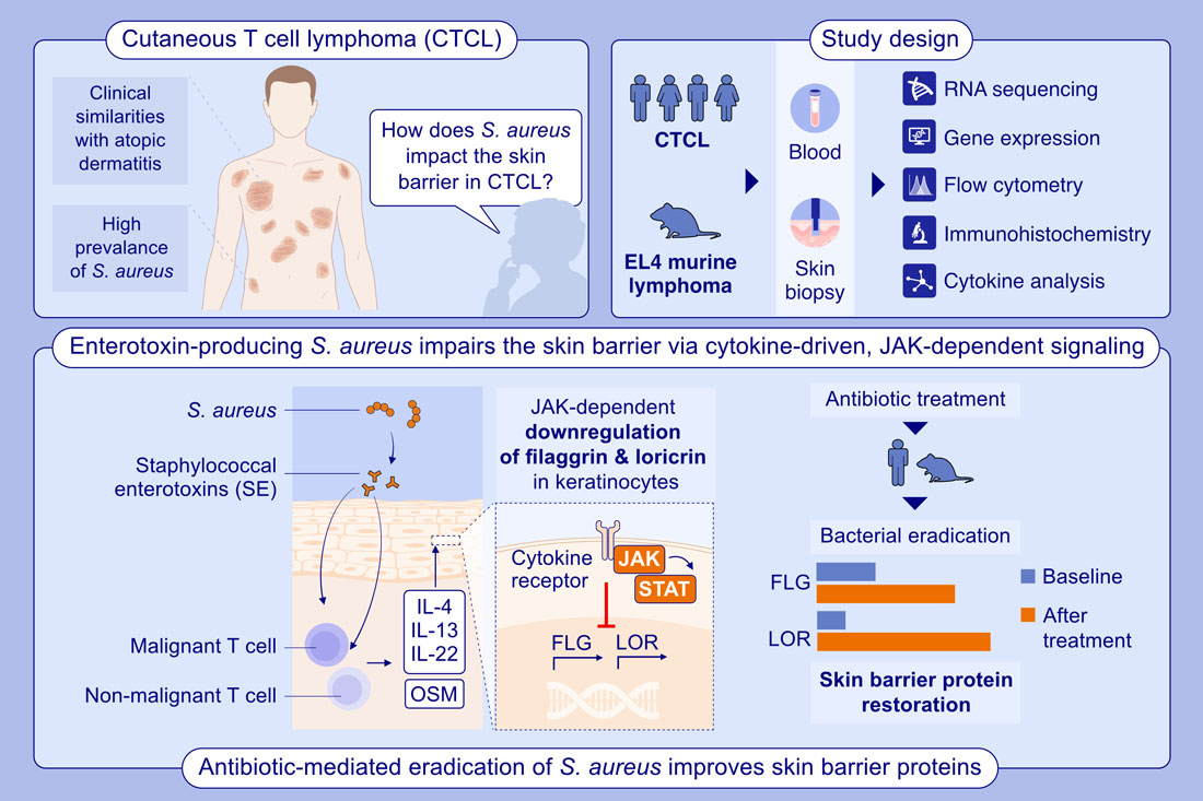 Staphylococcus aureus Augments Epithelial Skin Barrier Damage Through T Cell Activation in Cutaneous T Cell Lymphoma